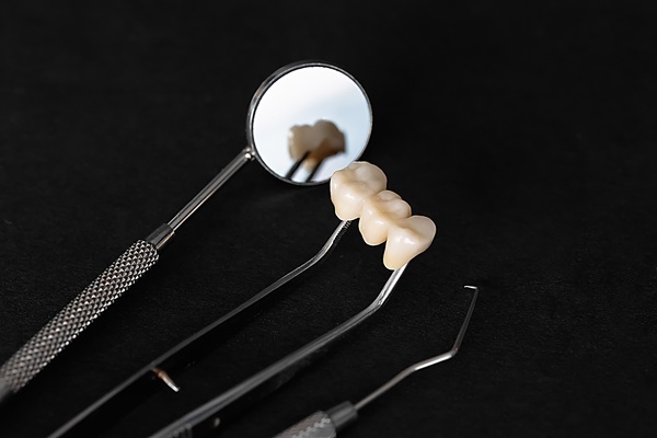 Understanding The Process For Dental Bridges