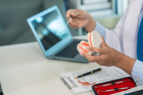 Types Of Dental Fillings By A General Dentist