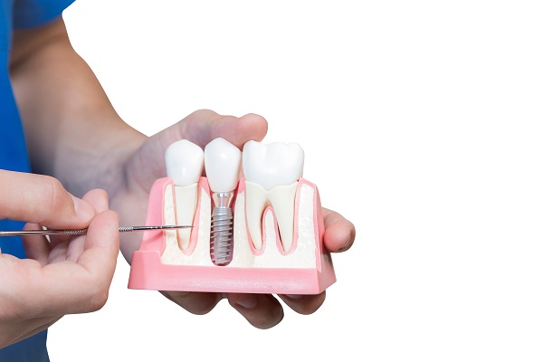 What Is Dental Implant Restoration?