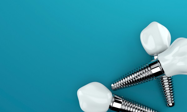 How To Care For Dental Implants