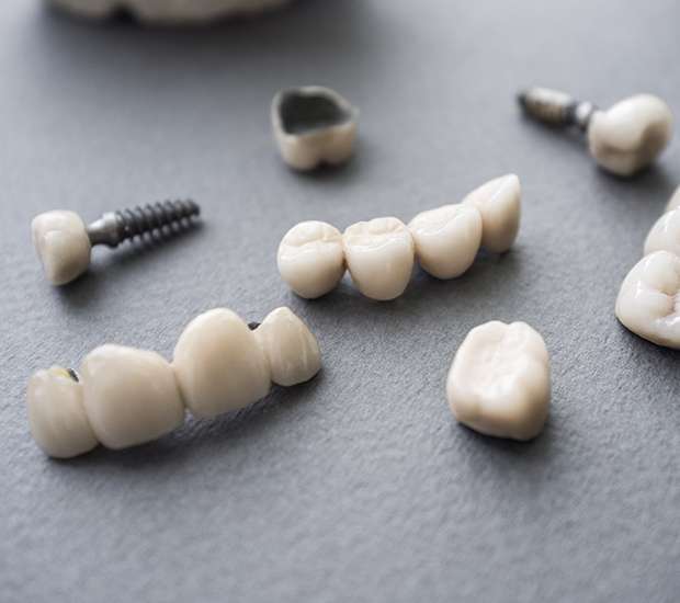 Los Gatos The Difference Between Dental Implants and Mini Dental Implants
