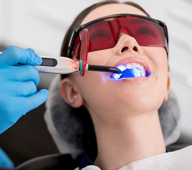 Los Gatos Professional Teeth Whitening